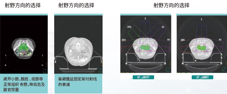 俯卧位盆腔定位垫