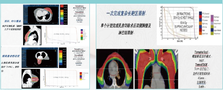 俯卧位乳腺定位垫